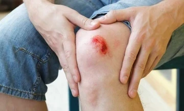 Dấu hiệu cơ thể đang thiếu kẽm trầm trọng