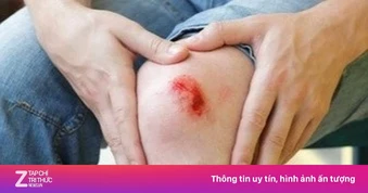 Dấu hiệu cơ thể đang thiếu kẽm trầm trọng
