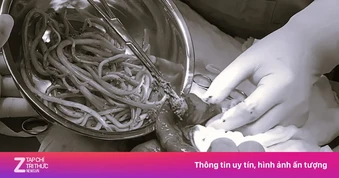 Dấu hiệu đến lúc cần xổ giun