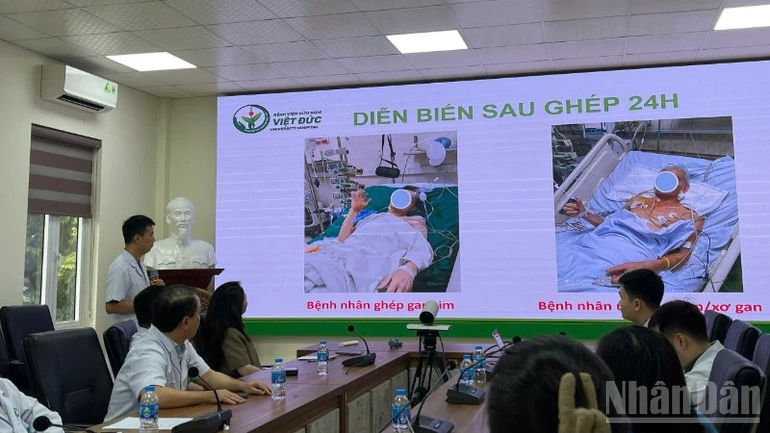 Dấu mốc mới trong lĩnh vực ghép tạng: Việt Nam lần đầu tiên triển khai ca ghép tạng domino Dấu mốc mới trong lĩnh vực ghép tạng: Việt Nam lần đầu tiên triển khai ca ghép tạng domino