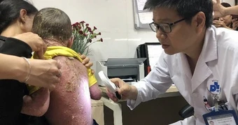 Đề xuất BHYT chi trả 50-70% thuốc sinh học điều trị vảy nến