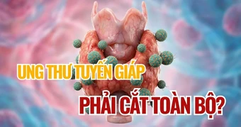 Điều gì quyết định phạm vi phẫu thuật tuyến giáp ở người mắc ung thư?