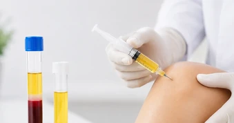 Điều trị thoái hóa khớp gối bằng huyết tương giàu tiểu cầu là gì?