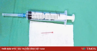 Đinh bắn xuyên đùi vì bất cẩn khi dùng máy bắn đinh