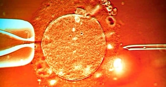 Đột phá mới: IVF có thể thực hiện ngay trong cơ thể người mẹ