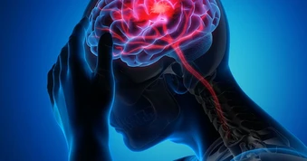 Đột quỵ gia tăng: Nghiên cứu Mỹ hé lộ thủ phạm mới
