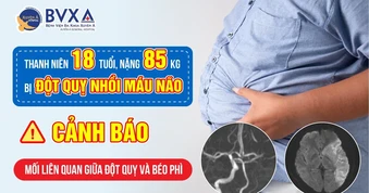 Đột quỵ không còn là bệnh của người già