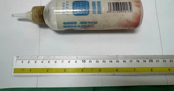 Đưa chai nhựa vào hậu môn, nam thanh niên phải nhập viện phẫu thuật lấy dị vật