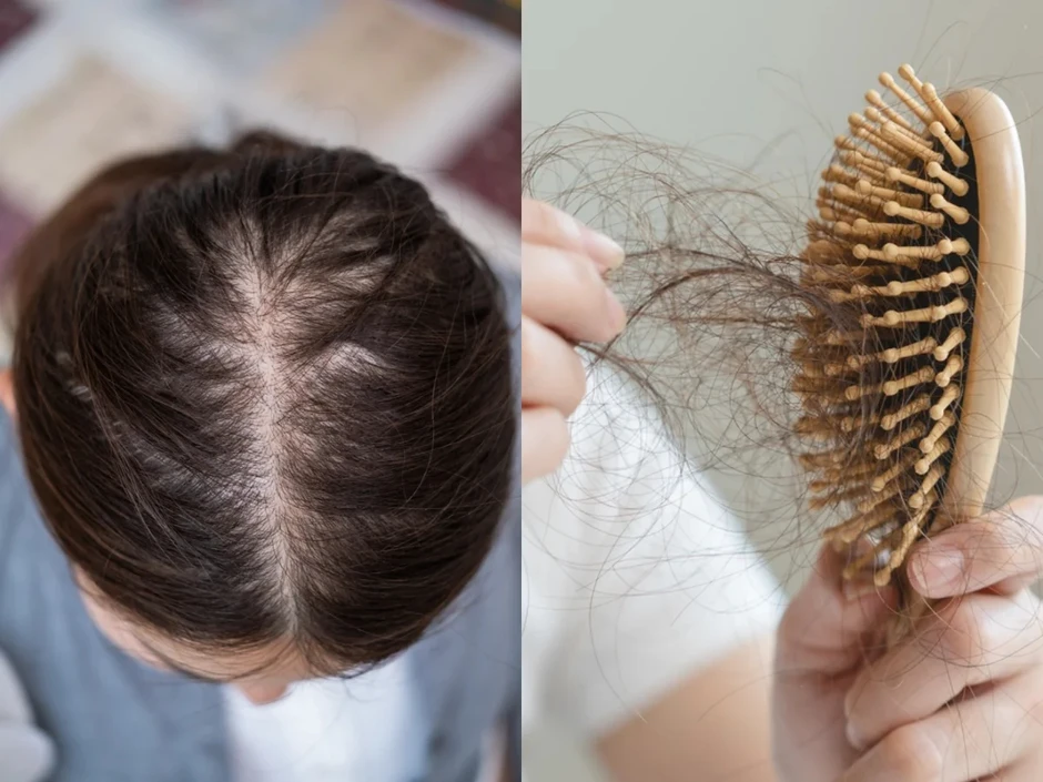 Đừng chỉ ăn trứng luộc để ngừa tóc rụng! "Nữ thần không tuổi" Thái Y Lâm luôn làm việc này trước 21h30 cho da đẹp tóc khỏe, bác sĩ cũng phải khen Đừng chỉ ăn trứng luộc để ngừa tóc rụng! "Nữ thần không tuổi" Thái Y Lâm luôn làm việc này trước 21h30 cho da đẹp tóc khỏe, bác sĩ cũng phải khen