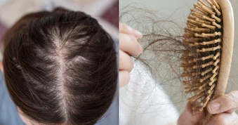 Đừng chỉ ăn trứng luộc để ngừa tóc rụng! "Nữ thần không tuổi" Thái Y Lâm luôn làm việc này trước 21h30 cho da đẹp tóc khỏe, bác sĩ cũng phải khen