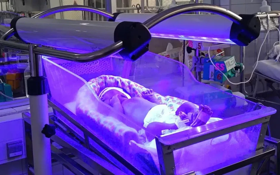 Đừng chủ quan khi trẻ sơ sinh bị vàng da Đừng chủ quan khi trẻ sơ sinh bị vàng da