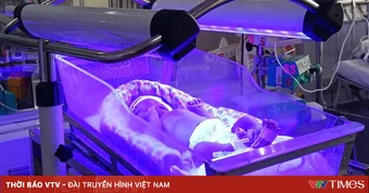 Đừng chủ quan khi trẻ sơ sinh bị vàng da