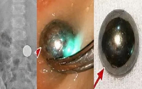Đừng chủ quan với đồ chơi bi nam châm Đừng chủ quan với đồ chơi bi nam châm