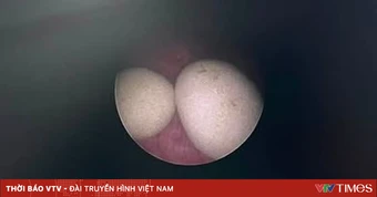 Đừng chủ quan với tiểu buốt, tiểu ra máu