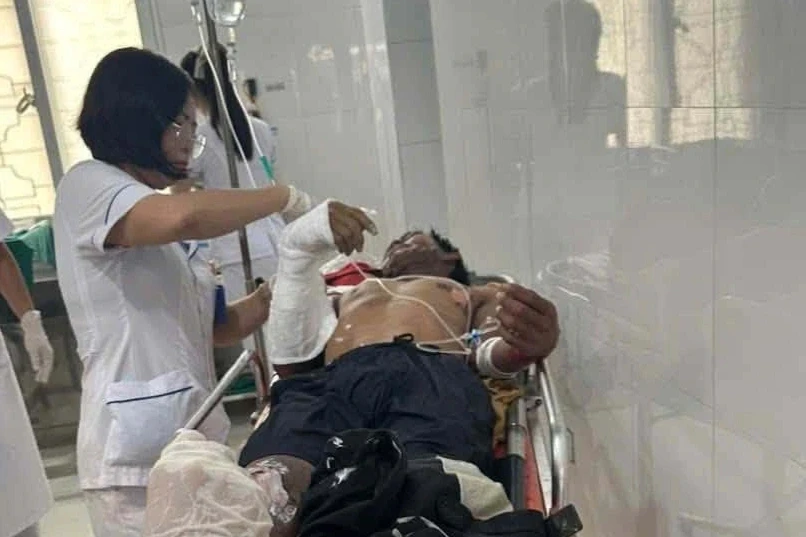 Dựng quán cà phê dưới đường dây điện, 2 người bị bỏng do nhiễm điện Dựng quán cà phê dưới đường dây điện, 2 người bị bỏng do nhiễm điện