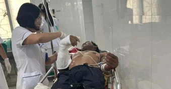 Dựng quán cà phê dưới đường dây điện, 2 người bị bỏng do nhiễm điện