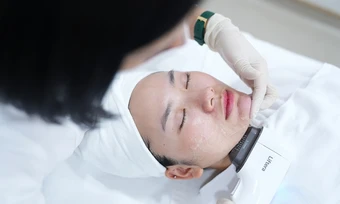 Dưới 30 tuổi có nên làm đẹp bằng công nghệ HIFU không? - Báo TinVina