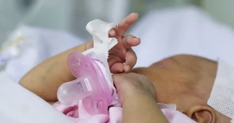Em bé chào đời với một phần trái tim bên ngoài cơ thể