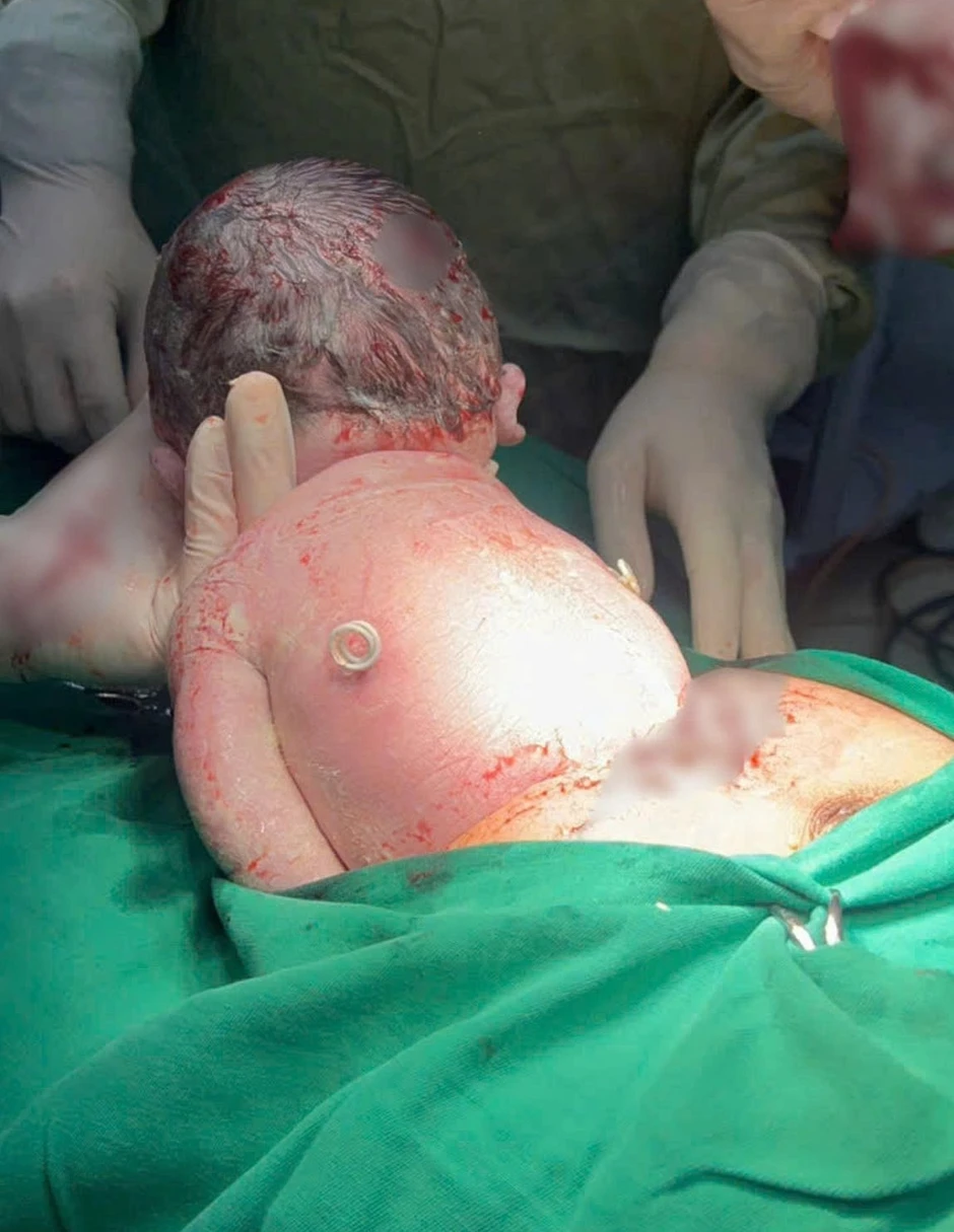 Em bé sinh ra với "đôi cánh nhỏ" trên lưng: Mẹ ơi! Con đến với mẹ rồi đây! Em bé sinh ra với "đôi cánh nhỏ" trên lưng: Mẹ ơi! Con đến với mẹ rồi đây!