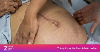 Gan tổn thương nặng vì sai lầm suốt 20 năm