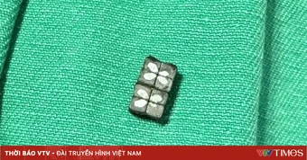 Gắp thành công 8 viên nam châm trong bụng bé trai