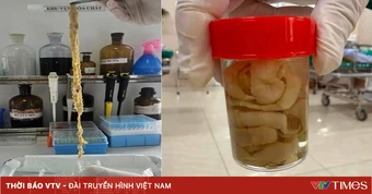 Gắp thành công sán dây bò dài 1,2 mét từ ruột người bệnh