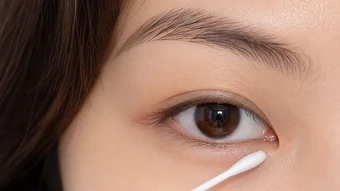 Ghèn mắt như thế nào cảnh báo bệnh? - Báo TinVina