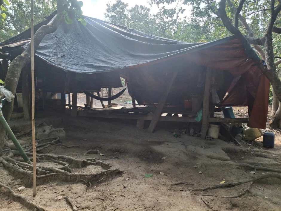 Ghi nhận ca dương tính với 'vi khuẩn ăn thịt người' tại Gia Lai Ghi nhận ca dương tính với 'vi khuẩn ăn thịt người' tại Gia Lai