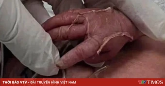 Giang mai bẩm sinh: Phòng bệnh từ thai kỳ