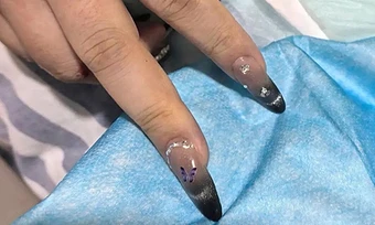 Gọi thợ làm móng đến phòng hồi sức để kịp cứu cô gái nguy kịch