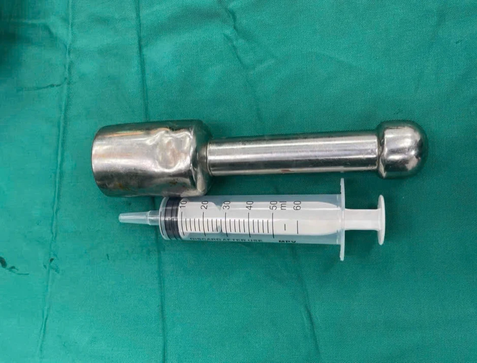 Hà Nội: Bác sĩ lấy dị vật kim loại bị kẹt trong trực tràng bé trai 15 tuổi Hà Nội: Bác sĩ lấy dị vật kim loại bị kẹt trong trực tràng bé trai 15 tuổi