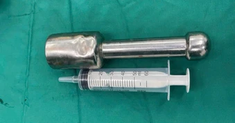 Hà Nội: Bác sĩ lấy dị vật kim loại bị kẹt trong trực tràng bé trai 15 tuổi