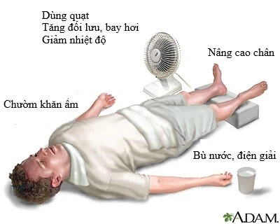 Hà Nội nắng nóng khắc nghiệt: Bác sĩ Bệnh viện Bạch Mai chỉ cách tránh say nắng, sốc nhiệt Hà Nội nắng nóng khắc nghiệt: Bác sĩ Bệnh viện Bạch Mai chỉ cách tránh say nắng, sốc nhiệt