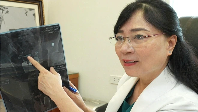 Hiếm muộn trẻ hóa, nhiều người trẻ suy giảm buồng trứng Hiếm muộn trẻ hóa, nhiều người trẻ suy giảm buồng trứng