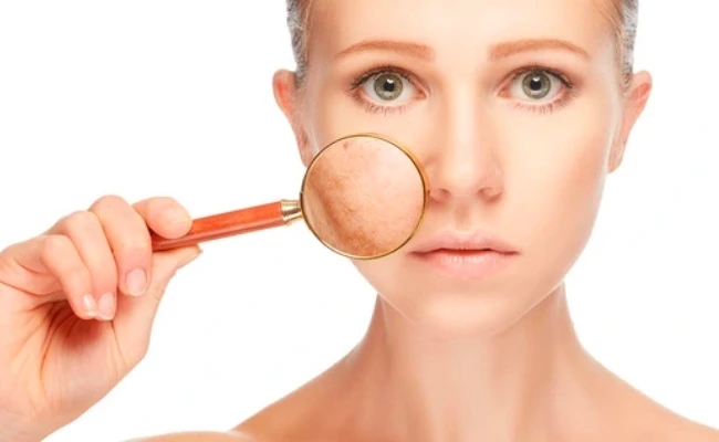 Hiệu quả tức thì của Hydroquinone: Khi "tốc độ" chưa chắc đồng hành cùng "sức khỏe" làn da Hiệu quả tức thì của Hydroquinone: Khi "tốc độ" chưa chắc đồng hành cùng "sức khỏe" làn da