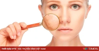 Hiệu quả tức thì của Hydroquinone: Khi "tốc độ" chưa chắc đồng hành cùng "sức khỏe" làn da
