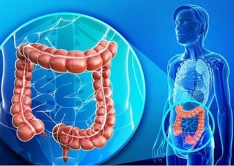Hội chứng ruột kích thích có chữa khỏi được không?