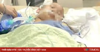 Hồi sinh bệnh nhi 15 tuổi sau xuất huyết não nặng