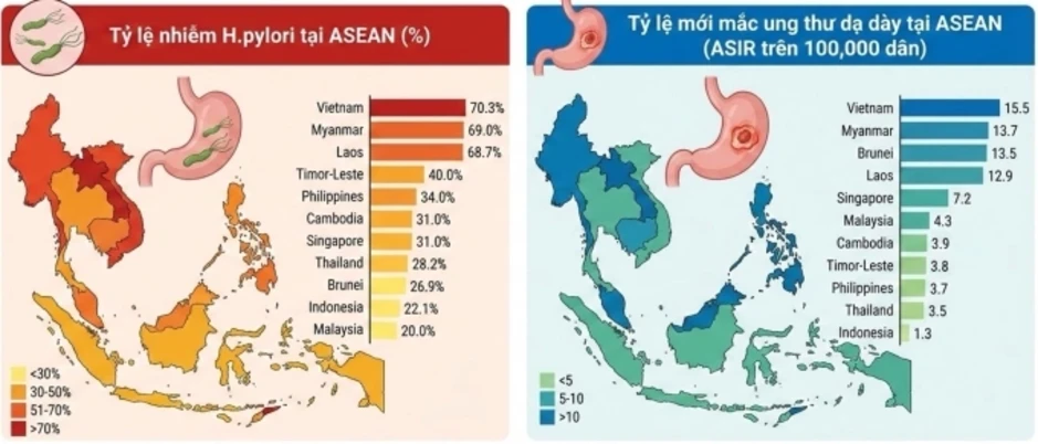 Hơn 70% người Việt nhiễm HP, ung thư dạ dày nhiều nhất Đông Nam Á