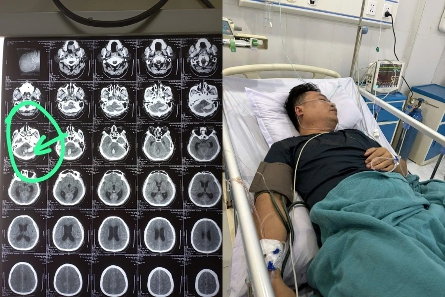 Hôn mê sau cơn đau đầu, thầy giáo được đưa xuyên đêm từ Lào về Việt Nam