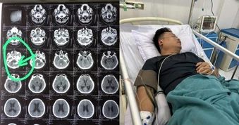 Hôn mê sau cơn đau đầu, thầy giáo được đưa xuyên đêm từ Lào về Việt Nam