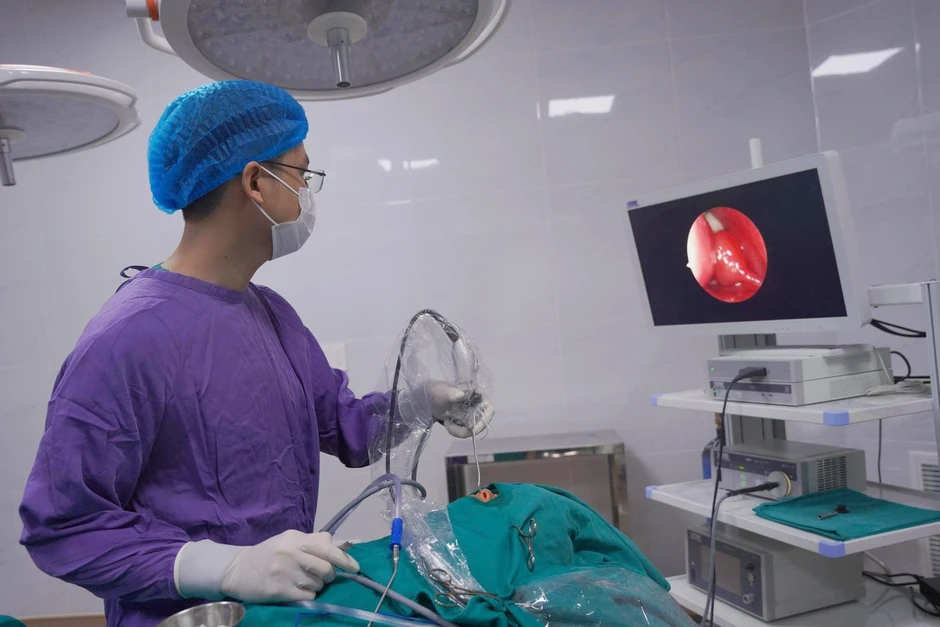 Hy hữu bé gái 8 tuổi có răng mọc trong hốc mũi Hy hữu bé gái 8 tuổi có răng mọc trong hốc mũi