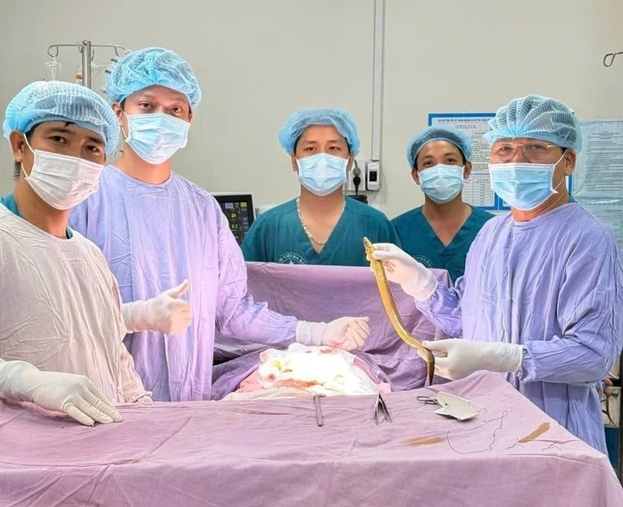 Hy hữu: Phẫu thuật lấy con lươn dài 50 cm chui vào bụng một bệnh nhân Hy hữu: Phẫu thuật lấy con lươn dài 50 cm chui vào bụng một bệnh nhân