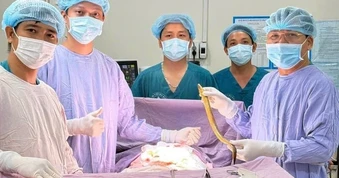 Hy hữu: Phẫu thuật lấy con lươn dài 50 cm chui vào bụng một bệnh nhân