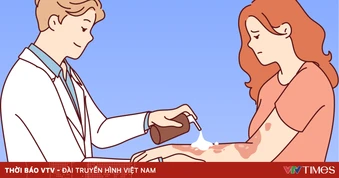 Infographic: Nhận diện bệnh thủy đậu ở người đã tiêm chủng