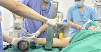 Kẹt nguyên bàn tay trong máy xay thịt, người phụ nữ phải phẫu thuật cắt cụt chi