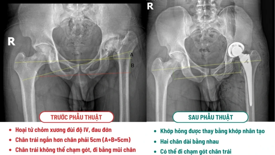 Khách Tây là kỹ sư vượt 10.000km sang 1 bệnh viện ở Việt Nam phẫu thuật Khách Tây là kỹ sư vượt 10.000km sang 1 bệnh viện ở Việt Nam phẫu thuật