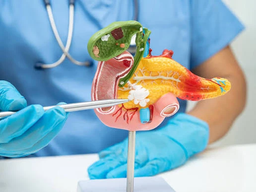 Khám cho nhiều người mắc ung thư tuyến tụy giai đoạn cuối, bác sĩ tiếc nuối: Dấu hiệu xuất hiện sớm nhưng hay bị bỏ qua