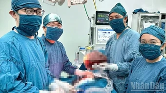 Khánh Hòa: Phẫu thuật thành công khối u vú diệp thể nặng gần 4kg
