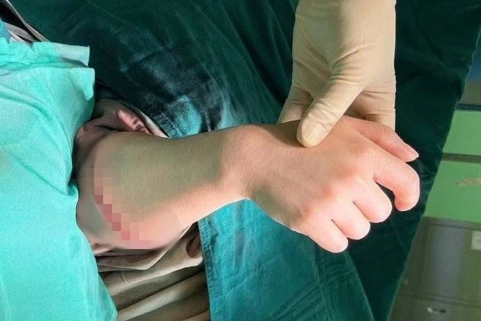 Khoảnh khắc cẳng tay được nối liền kỳ diệu, khi 6 giờ trước còn đứt lìa